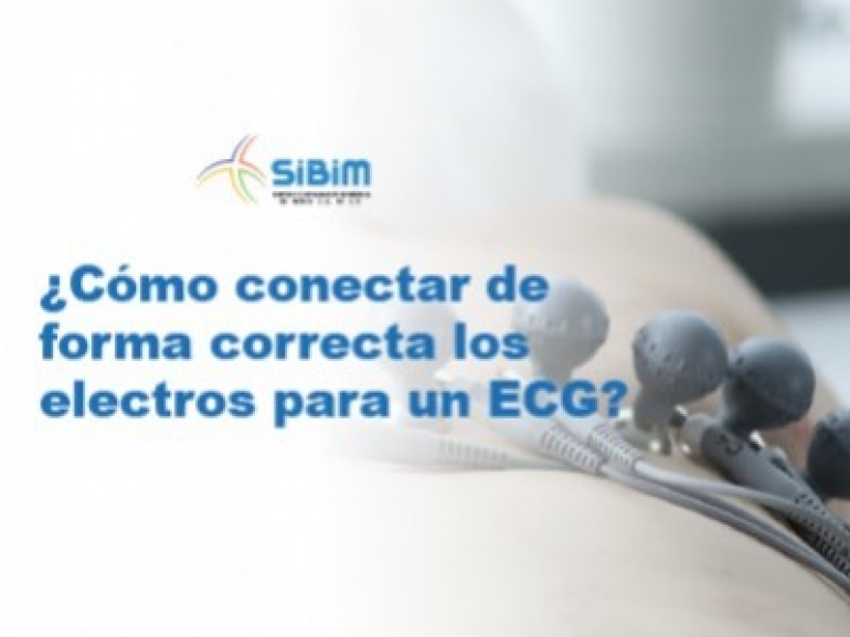 ¿Cómo conectar los electrodos correctamente para un ECG?