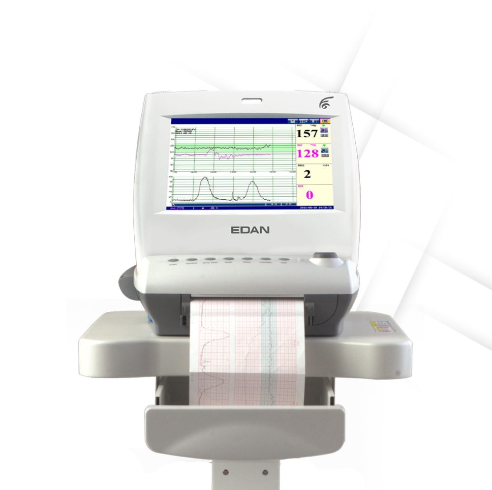 Monitor Fetal y Maternal F6 | EDAN - Image 2