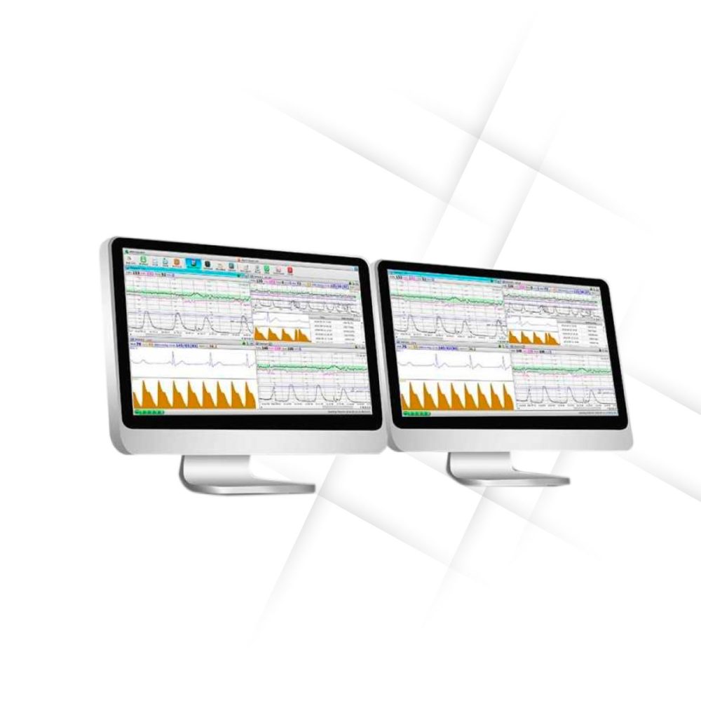 Software para Central de Monitoreo Fetal MFM-CNS + Monitor F3 Singular | EDAN